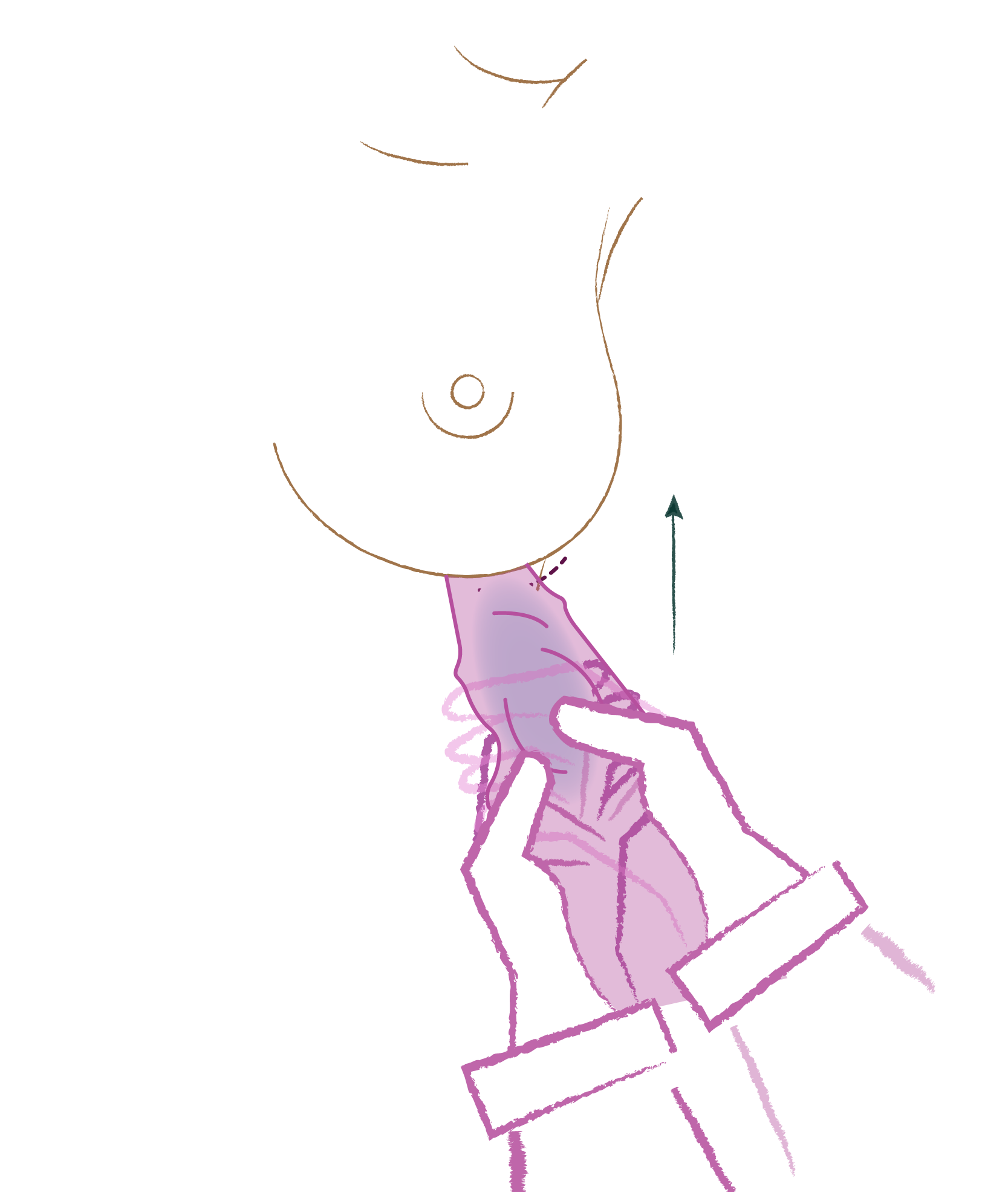 3 · Inserción Ergonomix2